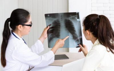 Cancer du poumon : le Kazakhstan lance un dépistage gratuit pour les fumeurs
